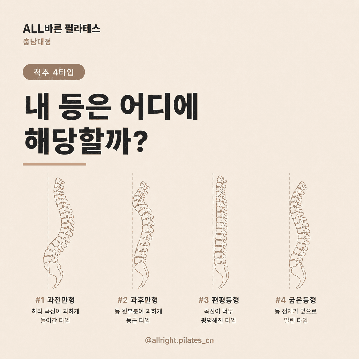 척추교정 4